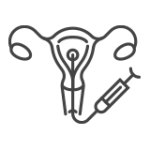 Inseminazione Intrauterina – Centro PMA Palmer Fecondazione artificiale: la prima fase del percorso, introduzione del seme maschile