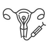 Inseminazione Intrauterina – Centro PMA Palmer Inseminazione Intrauterina - Centro PMA Palmer
