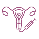 Inseminazione Intrauterina – Centro PMA Palmer Fecondazione Omologa - Inseminazione intrauterina