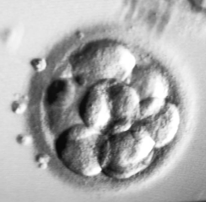 Embrioni al terzo giorno di sviluppo. Rubrica Lo sai che...del Centro PMA Palmer.
